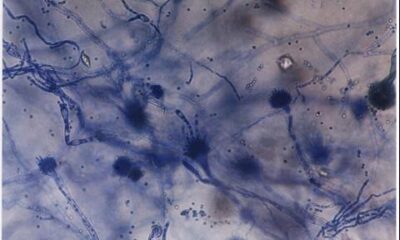 aspergillus odo recall arizona