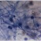 aspergillus odo recall arizona