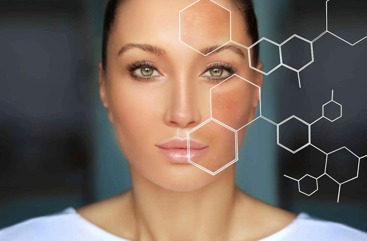 How Do Experts Select the Right Pigment Treatment Approach?