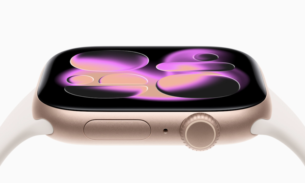 Apple Watch Series 11