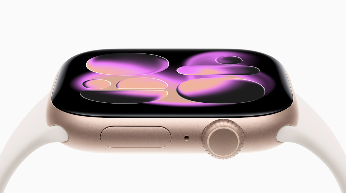 Apple Watch Series 11